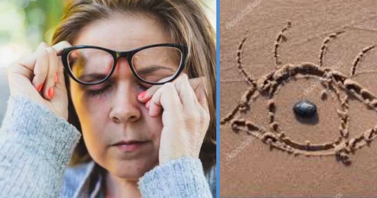 Crisp How To Get Rid Of Sand Feeling In Eyes View Illustration Crisp How To Get Rid Of Sand Feeling In Eyes View Illustration