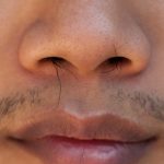 6 Facts About Protruding Nose Hair, An Embarrassing Issue That Men Above 30 Face
