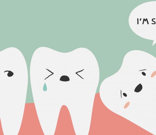 10 Facts About Wisdom Teeth & Whether They Should Be Extracted Or Not
