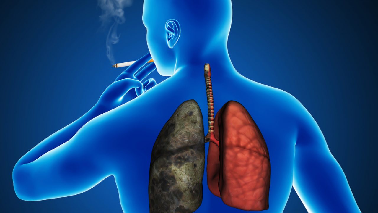 Smoker cough Telegraph