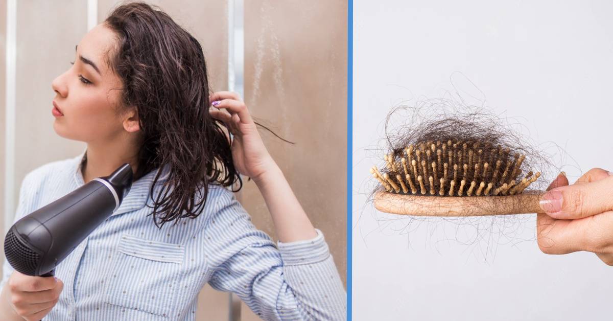 10 Legit Ways To Deal With Hair Loss Problems - Goody Feed