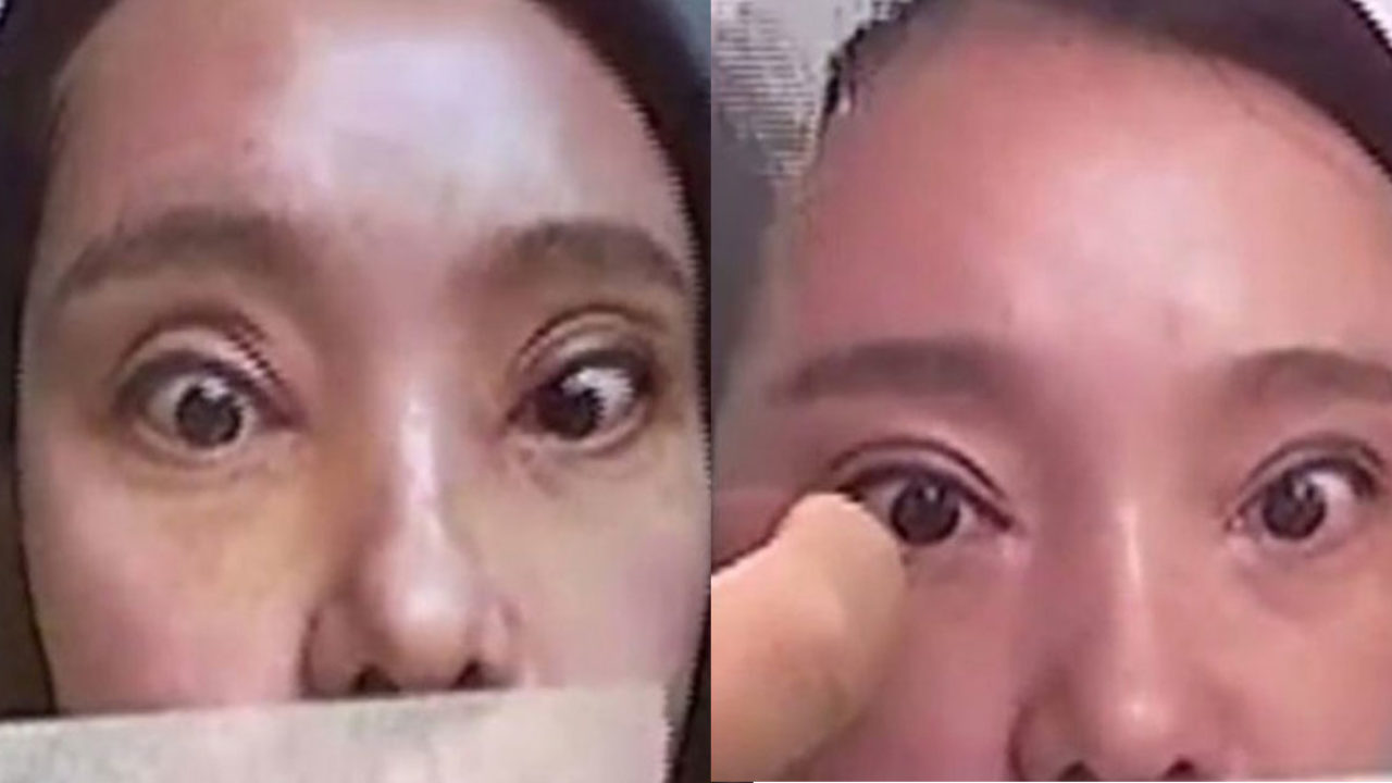 chinese eye surgery