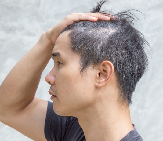 Would Pulling Out 1 White Hair Lead to 3 New White Hair?