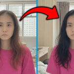 My Hair Loss Got More Serious In the Last Few Months & This Visit Was The Turning Point