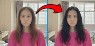 My Hair Loss Got More Serious In the Last Few Months & This Visit Was The Turning Point