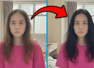 My Hair Loss Got More Serious In the Last Few Months & This Visit Was The Turning Point