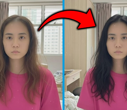 My Hair Loss Got More Serious In the Last Few Months & This Visit Was The Turning Point