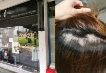 Woman Got Large Bald Spot While Straightening & Dyeing Hair; Salon Denies Wrongdoing After Customer Demands $10k Compensation