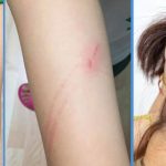 9YO Girl Allegedly Abused at Childcare Centre for Returning 30 Min Late From Lunch; Police Investigating