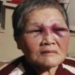 Chinese Grandma Who Was Assaulted by Caucasian Man Gives Away S$1.25m to Help Asian American Community