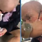 Elderly Man Left With Bloody Face After Being Allegedly Hit By E-Scooter At Whampoa Void Deck