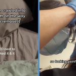 Woman Had to Rush to TTS Hospital After a Cockroach Crawled into Her Ear