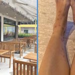 Woman Bitten by Sandflies While Dining at Sengkang Outdoor Food Court