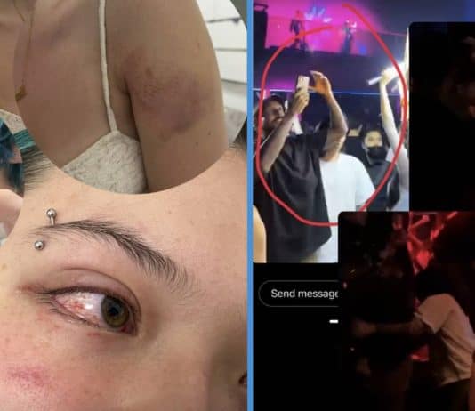 2 Women Attacked by Unknown Men While Clubbing at Marquee