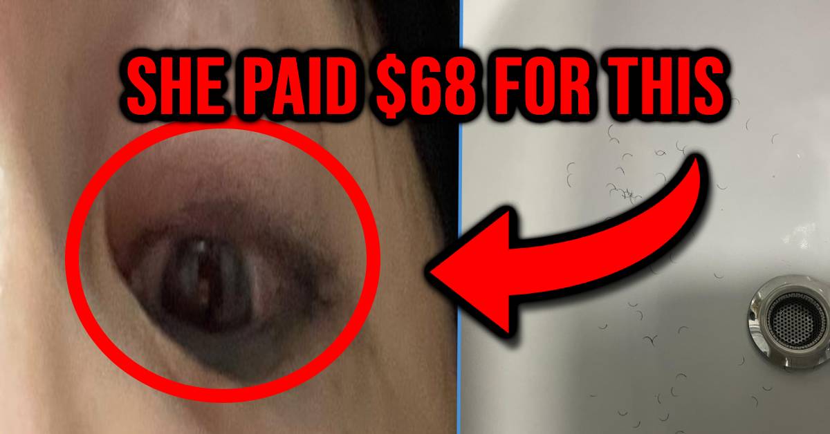 Woman Suffers Swollen Eyes from Fake Eyelashes Done by Bugis Beauty