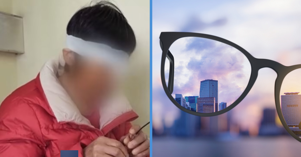 A Woman Has to Remove Her Eyeballs As Her 3,000Degree Myopia Caused a