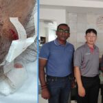 74YO Security Guard Assaulted by Potong Pasir Condo Resident Repeatedly, Leaving Him Bleeding