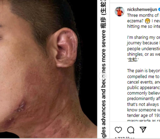Former Mediacorp Actor Nick Shen Opens Up About His Battle Against Shingles That Caused Paralysis in Half of His Face