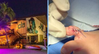 Tourist’s Daughter Suffers Deep Cut on Toe After Playing in Ola Beach Club’s Swimming Pool