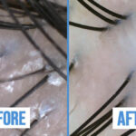 I Blamed Stress, Hormones, and Even My Pillowcase for my Hair Loss, But the Problem Was My Scalp