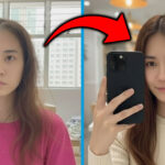 My Hair Loss Got More Serious In the Last Few Months & This Visit Was The Turning Point