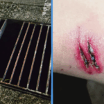 Woman Walking Home from Work Falls into Rusty Drain at Buona Vista woman-falls-rusty-drain-buona-vista