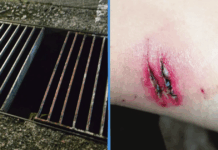 woman-falls-rusty-drain-buona-vista