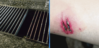 woman-falls-rusty-drain-buona-vista