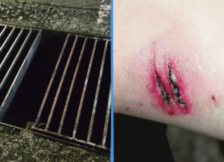 woman-falls-rusty-drain-buona-vista