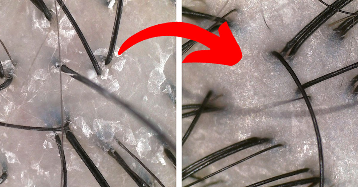 I Always Thought Hair Loss Only Comes With Old Age, Little Did I Know That I Was So Wrong…