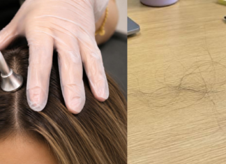 The Biggest Loss I Faced So Far Cost Me More Than My Hair Loss