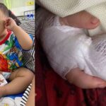 Thai Hospital Expresses Regret After Nursing Assistant Accidentally Severs 1-Year-Old Boy’s Fingertip Bandaged 1-year-old boy after Thai hospital nursing assistant severed fingertip during IV removal
